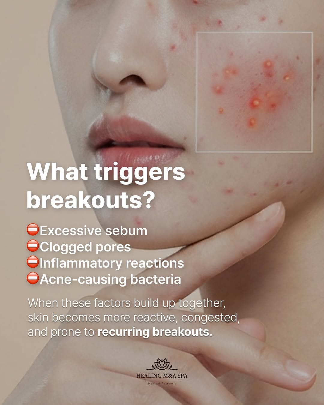 Skin Treatments at Healing M&A Spa